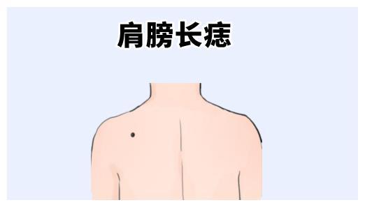 肩膀上有痣所代表命运含义如何 肩上的痣什么寓意