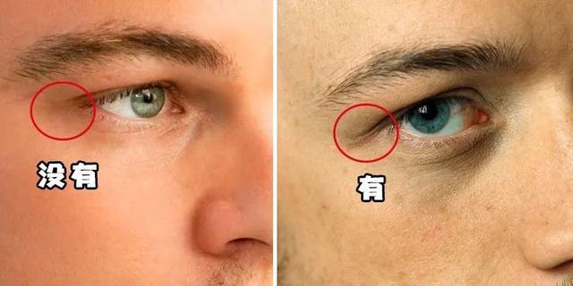 眼睛周围有伤疤是福气吗 眼尾有疤的男人面相