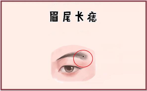 女人眉尾有痣代表什么含义 一、解析女人眉尾有痣代表的意思